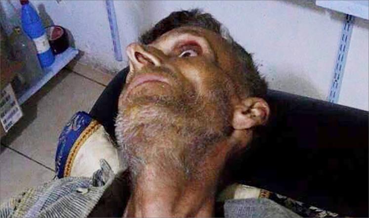   به‌ وێنه‌.. منداڵانی مه‌زایا له‌ برسان ده‌مرن